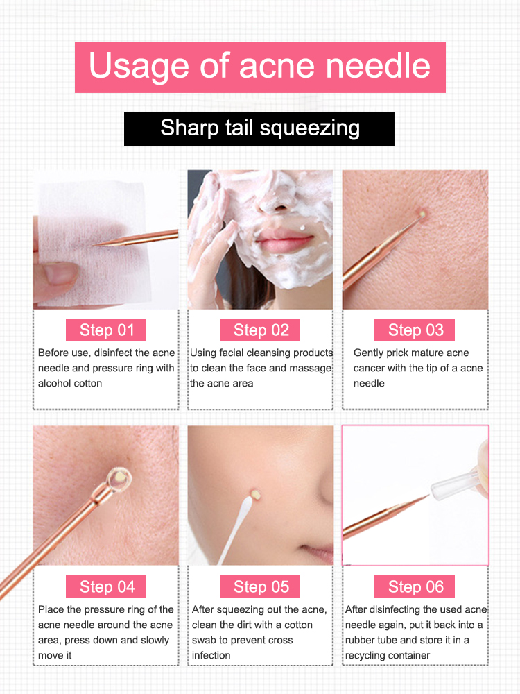 Blackhead Remover Pimple Comed - đánh giá và giá Luxury Skincare Acne