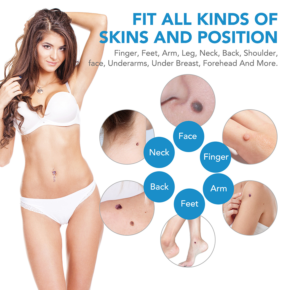 2-IN-1 Auto Skin Tag Removal T - đánh giá và giá Luxury Skincare Acne