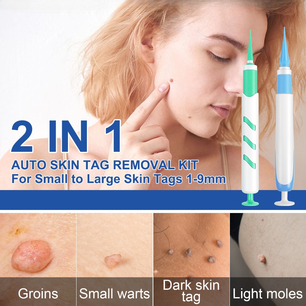 2-IN-1 Auto Skin Tag Removal T - đánh giá và giá Luxury Skincare Acne