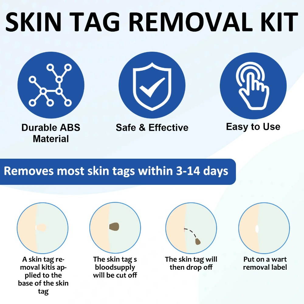 2-IN-1 Auto Skin Tag Removal T - đánh giá và giá Luxury Skincare Acne