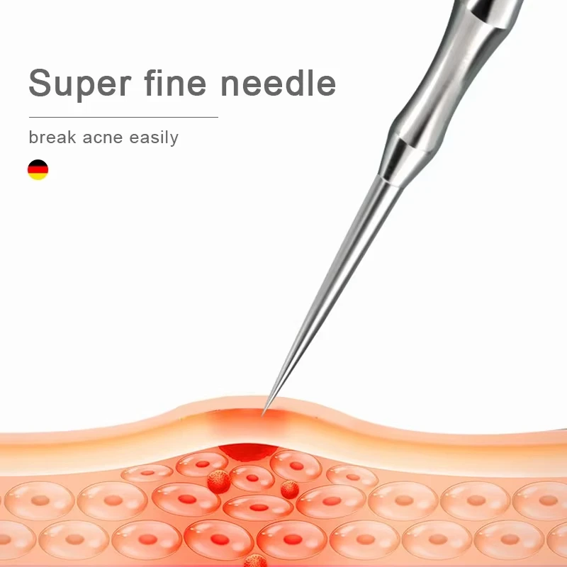 New German Style Blackhead Rem - đánh giá và giá Luxury Skincare Acne