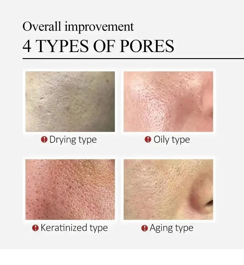 Centella Asiatica Shrink Pores - đánh giá và giá Luxury Skincare Korea
